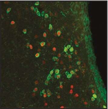 抗-ARP2抗体，小鼠单克隆 clone FMS96, purified from hybridoma cell culture