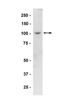 Anti-PKD2 Antibody Upstate&#174;, from rabbit