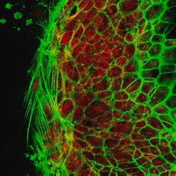 Anti-Pumilio-2 (PUM2) Antibody from rabbit, purified by affinity chromatography