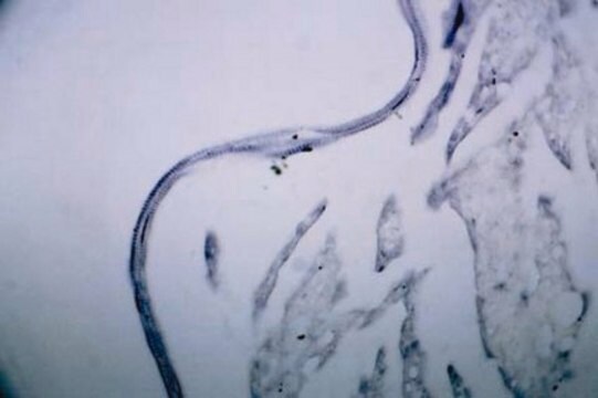 Anti-Muscarinic Acetylcholine Receptor m2 Antibody Chemicon&#174;, from rabbit