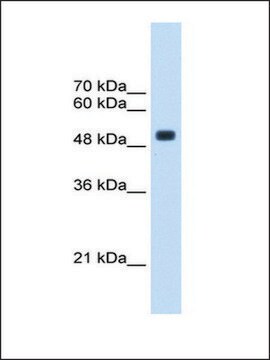 抗CXORF34抗体 ウサギ宿主抗体 IgG fraction of antiserum