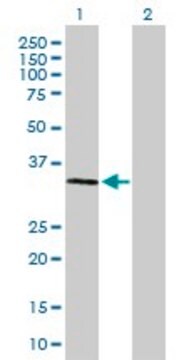 Anti-SSR1 antibody produced in mouse purified immunoglobulin, buffered aqueous solution