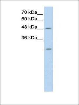 Anti-ANKRD2 antibody produced in rabbit affinity isolated antibody