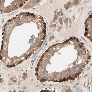 Anti-OXSR1 antibody produced in rabbit Prestige Antibodies&#174; Powered by Atlas Antibodies, affinity isolated antibody, buffered aqueous glycerol solution