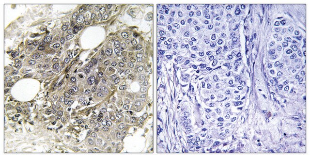 Anti-TGF &#946; Receptor III, C-Terminal antibody produced in rabbit affinity isolated antibody