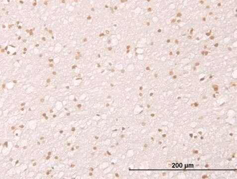 Monoclonal Anti-MDM2 antibody produced in mouse clone 1A7, purified immunoglobulin, buffered aqueous solution