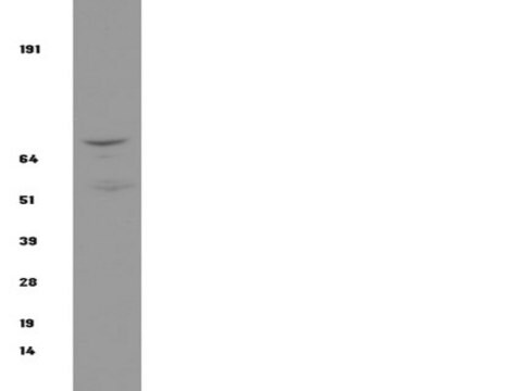 Przeciwciało anty-IKKβ, klon 10AG2 clone 10AG2, Upstate&#174;, from mouse