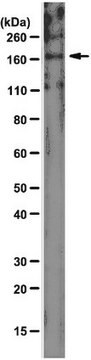 Przeciwciało anty-UPAR-Associated Protein, klon 2.h.9:F12 clone 2.h.9:F12, from mouse