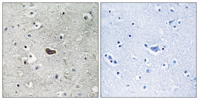 Anti-PKC &#948; antibody produced in rabbit affinity isolated antibody