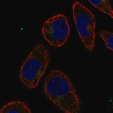 Anti-CD36 antibody produced in rabbit Prestige Antibodies&#174; Powered by Atlas Antibodies, affinity isolated antibody