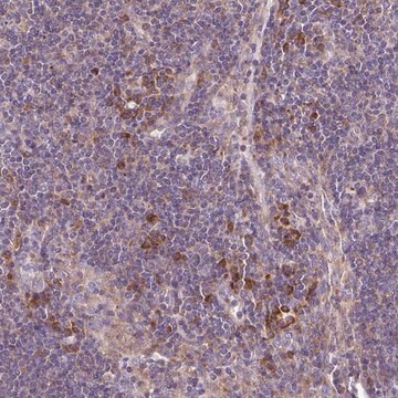 Anti-RPL13 antibody produced in rabbit Prestige Antibodies&#174; Powered by Atlas Antibodies, affinity isolated antibody, buffered aqueous glycerol solution