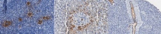 Anti-Peripheral Node Addressin (PNAd) Antibody, clone MECA-79 clone MECA-79, from rat