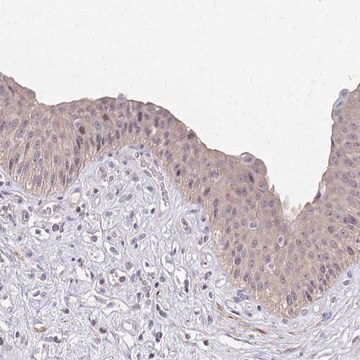 Anti-IFI44L antibody produced in rabbit Prestige Antibodies&#174; Powered by Atlas Antibodies, affinity isolated antibody, buffered aqueous glycerol solution