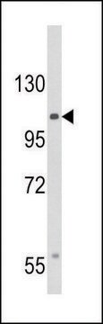 ANTI-CACNA2D3 (C-TERM) antibody produced in rabbit IgG fraction of antiserum, buffered aqueous solution