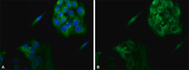 抗钙联蛋白 兔抗 IgG fraction of antiserum, buffered aqueous solution