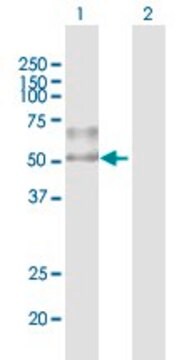 Anti-ENTPD1 antibody produced in mouse purified immunoglobulin, buffered aqueous solution