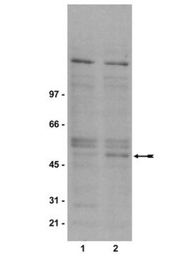 Anti-Phospho-GSK3&#946; (Ser9) Antikörper, Klon&nbsp;2D3 clone 2D3, Upstate&#174;, from mouse