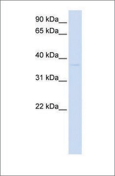 Anti-GDAP1L1 antibody produced in rabbit affinity isolated antibody