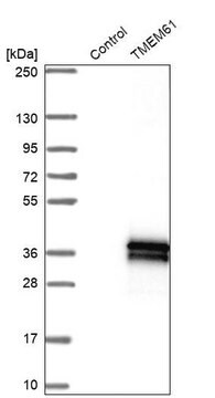 Anti-TMEM61 antibody produced in rabbit Prestige Antibodies&#174; Powered by Atlas Antibodies, affinity isolated antibody, buffered aqueous glycerol solution