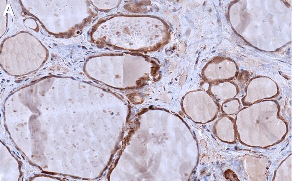 Anti-JNK1 Antibody, clone 1C18 ZooMAb&#174; Rabbit Monoclonal recombinant, expressed in HEK 293 cells