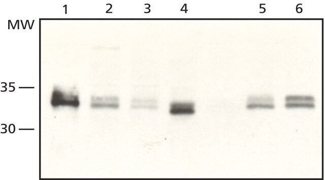 Anti-Sprouty 2 (N-Terminal) from rabbit affinity isolated antibody, buffered aqueous solution