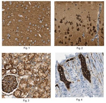 Anti-Tau Antibody, clone T49 (Not human) clone T49, from mouse