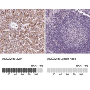 Anti-ACOX2 antibody produced in rabbit Prestige Antibodies&#174; Powered by Atlas Antibodies, affinity isolated antibody