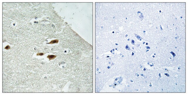 Anti-Period Circadian Protein 2 (Phospho-SER662) affinity isolated antibody