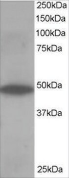 Anti-ORP1 antibody produced in goat affinity isolated antibody, buffered aqueous solution