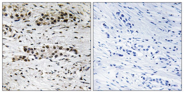 Anty-fosfo-EstrogenReceptor-α (pSer102) affinity isolated antibody