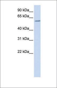 Anti-ZBTB7A antibody produced in rabbit affinity isolated antibody