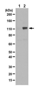 Anti-Phospho-Androgenrezeptor(Ser81)-Antikörper Upstate&#174;, from rabbit