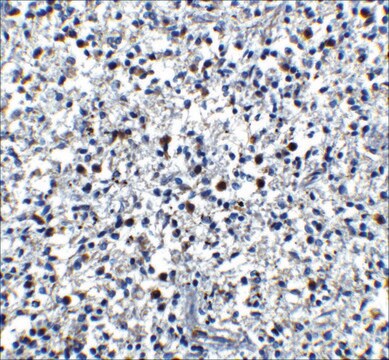 Anti-Cathelicidin antibody produced in rabbit affinity isolated antibody, buffered aqueous solution