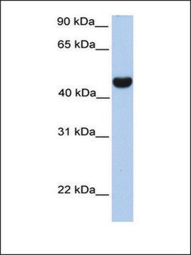 Anti-RTN4 (AB1) antibody produced in rabbit affinity isolated antibody