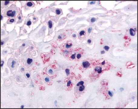 Anti-DDR1 (AB1) antibody produced in rabbit affinity isolated antibody, buffered aqueous solution