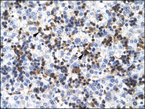 Anti-RUVBL2 antibody produced in rabbit affinity isolated antibody