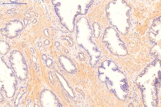 Anti-CDKN1A (N-terminal) antibody produced in rabbit affinity isolated antibody