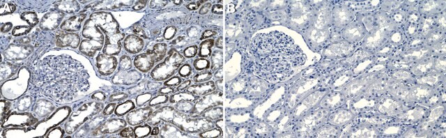 Anti-OPA1 Antibody, clone 1F15 ZooMAb&#174; Rabbit Monoclonal recombinant, expressed in HEK 293 cells