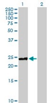 Anti-HYAL1 antibody produced in rabbit purified immunoglobulin, buffered aqueous solution