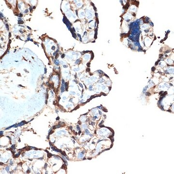 Anti-ATF5 antibody produced in rabbit