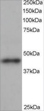 Anti-ARP1 homolog B antibody produced in goat affinity isolated antibody, buffered aqueous solution