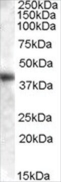 Anti-GOT1 (AA 157-167) antibody produced in goat affinity isolated antibody, buffered aqueous solution