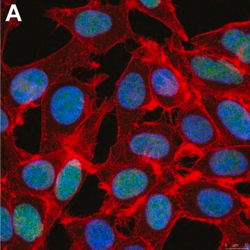 Anti-ZEB1 Antibody, clone 5C20 ZooMAb&#174; Rabbit Monoclonal recombinant, expressed in HEK 293 cells