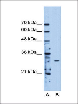 Anti-METTL1 antibody produced in rabbit IgG fraction of antiserum