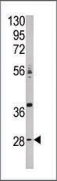 Anti-CA9 (N-term) antibody produced in rabbit IgG fraction of antiserum, buffered aqueous solution