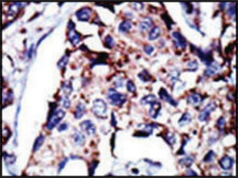 Anti-DGKD (C-term) antibody produced in rabbit IgG fraction of antiserum, buffered aqueous solution