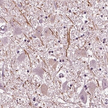 Anti-CNGA3 antibody produced in rabbit Prestige Antibodies&#174; Powered by Atlas Antibodies, affinity isolated antibody