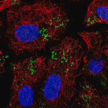 Anti-PNPLA2 antibody produced in rabbit Prestige Antibodies&#174; Powered by Atlas Antibodies, affinity isolated antibody