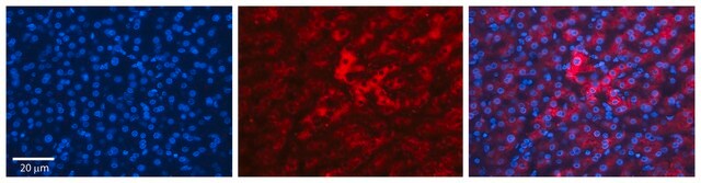 Anti-HP antibody produced in rabbit affinity isolated antibody