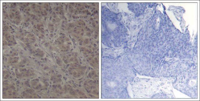 Anti-RPS6KA1 (Ab-352) antibody produced in rabbit affinity isolated antibody